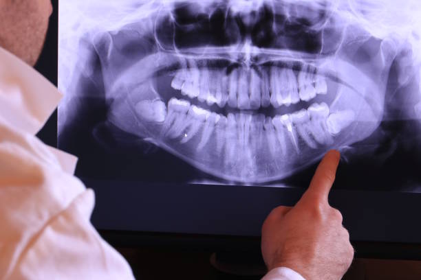 Best 24-Hour Emergency Dental Care in Aptos Hills Larkin Valley, CA